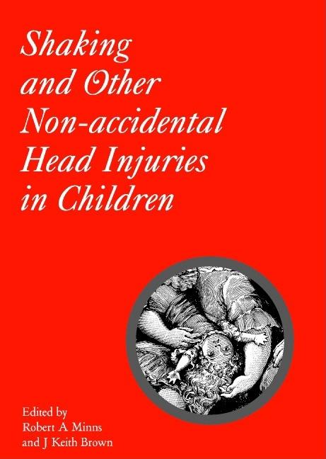 Shaking and Other Non-Accidental Head Injuries in Children - Ingram