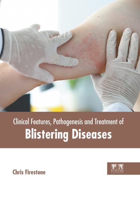Clinical Features, Pathogenesis and Treatment of Blistering Diseases - Ingram