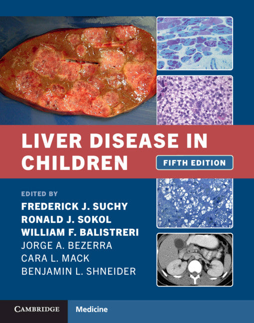 Liver Disease in Children - Ingram