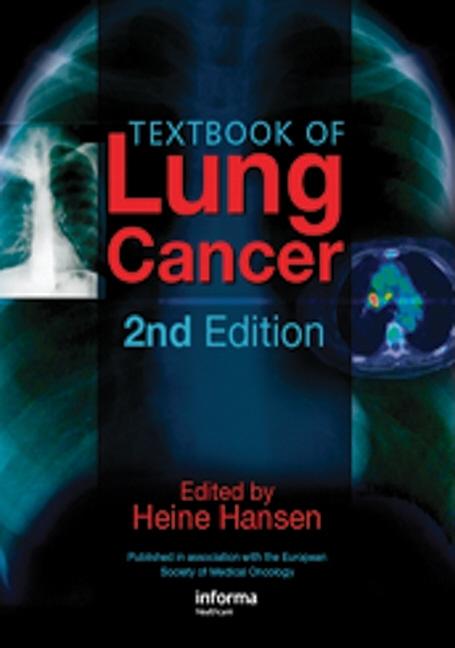 Textbook of Lung Cancer - Ingram