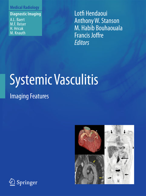 Systemic Vasculitis: Imaging Features (2012) - Ingram