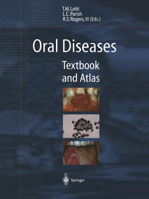 Oral Diseases: Textbook and Atlas (Softcover Reprint of the Original 1st 1999) - Ingram