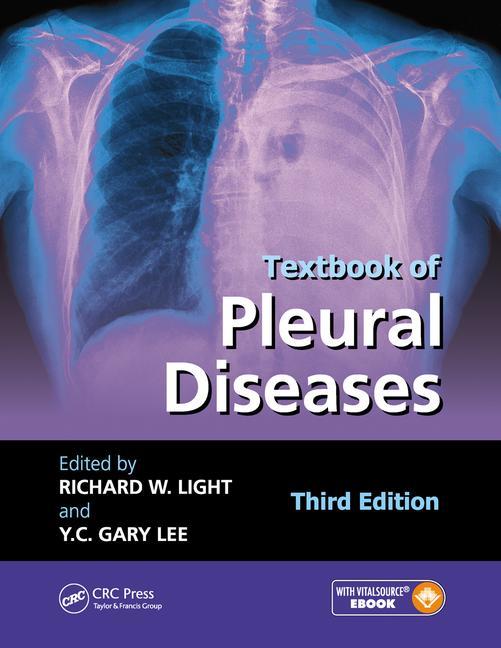 Textbook of Pleural Diseases - Ingram