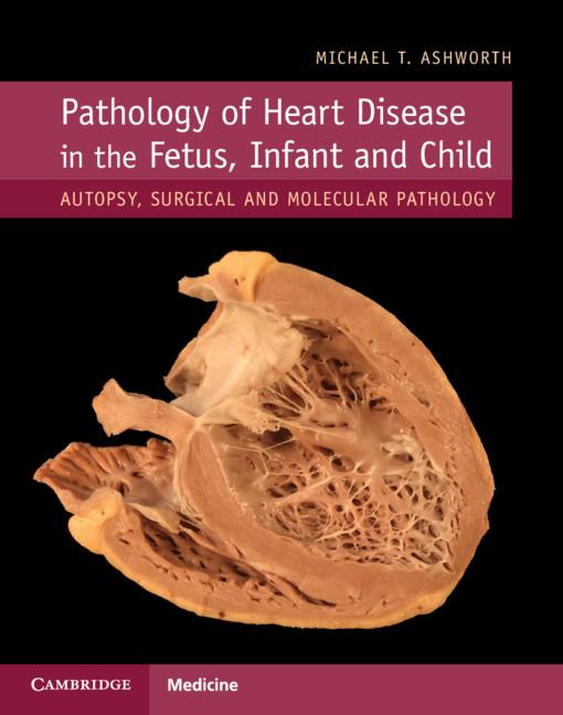 Pathology of Heart Disease in the Fetus, Infant and Child: Autopsy, Surgical and Molecular Pathology - Ingram