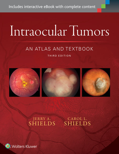 Intraocular Tumors: An Atlas and Textbook: Volume 1 - Ingram