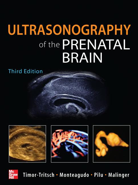 Ultrasonography of the Prenatal Brain - Ingram