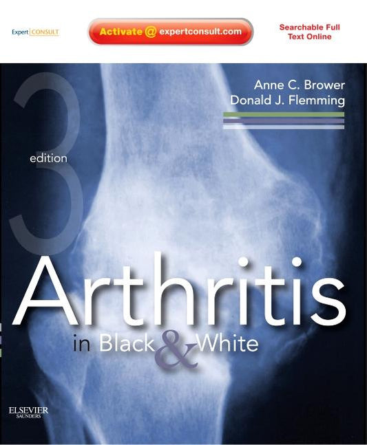Arthritis in Black & White - Ingram