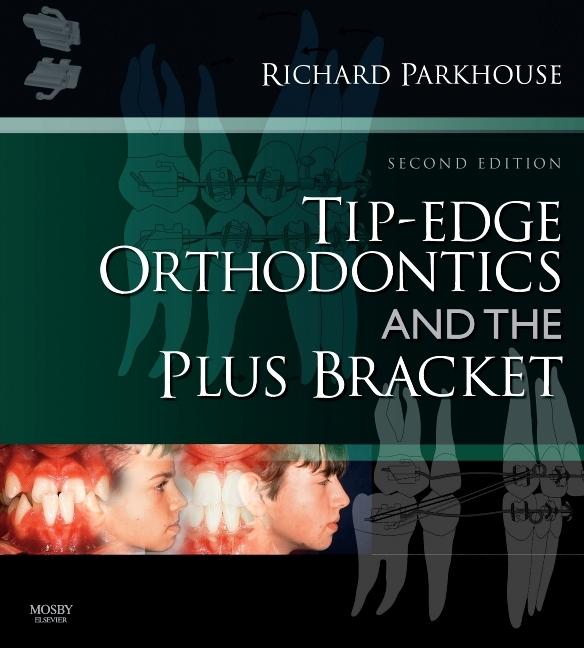Tip-Edge Orthodontics and the Plus Bracket - Ingram