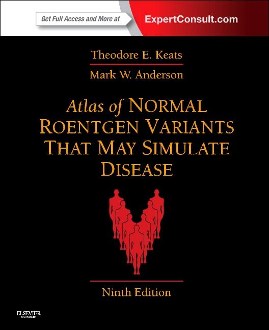 Atlas of Normal Roentgen Variants That May Simulate Disease: Expert Consult - Enhanced Online Features and Print (Revised) - Ingram