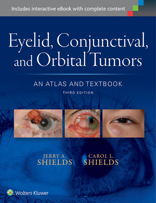 Eyelid, Conjunctival, and Orbital Tumors: An Atlas and Textbook - Ingram